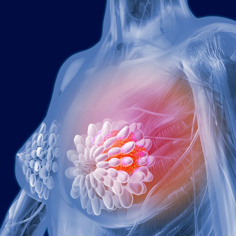 Illustration showing breast awareness and early detection